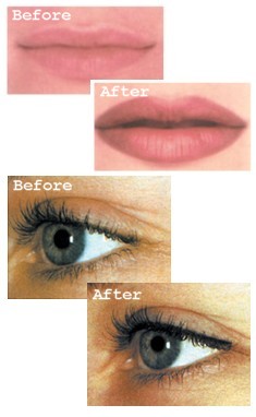 Clinic  on Semi Permanent Make Up Treatment After Care Bexhill On Sea East Sussex